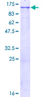 ab160451 on a 12.5% SDS-PAGE stained with Coomassie Blue.