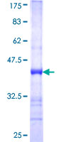 ab165772 on a 12.5% SDS-PAGE stained with Coomassie Blue.