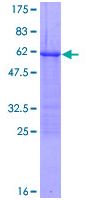 ab114261 analysed by 12.5% SDS-PAGE and stained with Coomassie Blue.