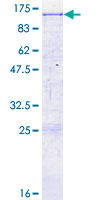 ab161871 on a 12.5% SDS-PAGE stained with Coomassie Blue.