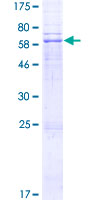 ab160719 on a 12.5% SDS-PAGE stained with Coomassie Blue.