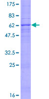 ab163867 on a 12.5% SDS-PAGE stained with Coomassie Blue.