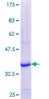 ab160392 on a 12.5% SDS-PAGE stained with Coomassie Blue.
