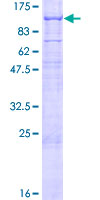 ab163608 on a 12.5% SDS-PAGE stained with Coomassie Blue.
