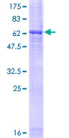 ab153584 on a 12.5% SDS-PAGE stained with Coomassie Blue.
