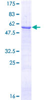 ab158828 on a 12.5% SDS-PAGE stained with Coomassie Blue.