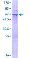 ab166385 on a 12.5% SDS-PAGE stained with Coomassie Blue.