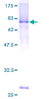 ab160894 on a 12.5% SDS-PAGE stained with Coomassie Blue.