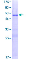 ab166557 on a 12.5% SDS-PAGE stained with Coomassie Blue.