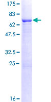 ab164029 on a 12.5% SDS-PAGE stained with Coomassie Blue.