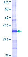 ab164030 on a 12.5% SDS-PAGE stained with Coomassie Blue.
