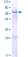ab165198 on a 12.5% SDS-PAGE stained with Coomassie Blue.