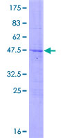 ab161934 on a 12.5% SDS-PAGE stained with Coomassie Blue.