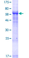 ab165635 on a 12.5% SDS-PAGE stained with Coomassie Blue.