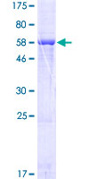 ab165283 on a 12.5% SDS-PAGE stained with Coomassie Blue.