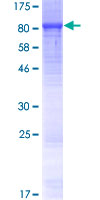 ab163155 on a 12.5% SDS-PAGE stained with Coomassie Blue.