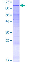 ab162857 on a 12.5% SDS-PAGE stained with Coomassie Blue.