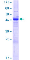 ab166044 on a 12.5% SDS-PAGE stained with Coomassie Blue.