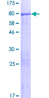 ab161732 on a 12.5% SDS-PAGE stained with Coomassie Blue.