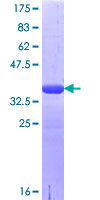ab163372 on a 12.5% SDS-PAGE stained with Coomassie Blue.