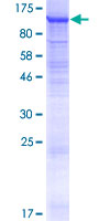 ab161669 on a 12.5% SDS-PAGE stained with Coomassie Blue.