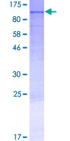 ab164201 on a 12.5% SDS-PAGE stained with Coomassie Blue.