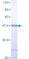 ab152962 on a 12.5% SDS-PAGE stained with Coomassie Blue.
