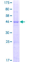 ab165273 on a 12.5% SDS-PAGE stained with Coomassie Blue.