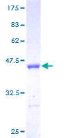 ab161737 on a 12.5% SDS-PAGE stained with Coomassie Blue.