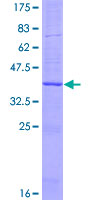 ab158833 on a 12.5% SDS-PAGE stained with Coomassie Blue.