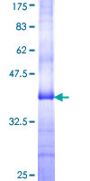 ab158835 on a 12.5% SDS-PAGE stained with Coomassie Blue.