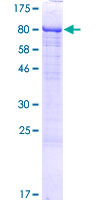 ab164707 on a 12.5% SDS-PAGE stained with Coomassie Blue.