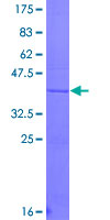 ab153060 on a 12.5% SDS-PAGE stained with Coomassie Blue.