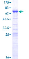 ab163179 on a 12.5% SDS-PAGE stained with Coomassie Blue.