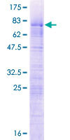 ab162617 on a 12.5% SDS-PAGE stained with Coomassie Blue.