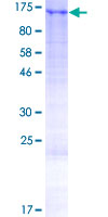 ab159888 on a 12.5% SDS-PAGE stained with Coomassie Blue.