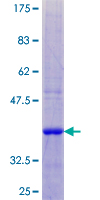 ab158836 on a 12.5% SDS-PAGE stained with Coomassie Blue.