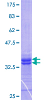 ab164905 on a 12.5% SDS-PAGE stained with Coomassie Blue.