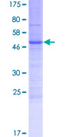 ab162829 on a 12.5% SDS-PAGE stained with Coomassie Blue.