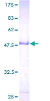 ab166172 on a 12.5% SDS-PAGE stained with Coomassie Blue.