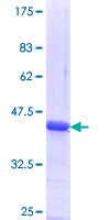 ab166173 on a 12.5% SDS-PAGE stained with Coomassie Blue.