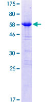 ab166066 on a 12.5% SDS-PAGE stained with Coomassie Blue.