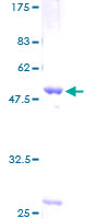 ab160989 on a 12.5% SDS-PAGE stained with Coomassie Blue.