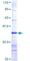 ab160990 on a 12.5% SDS-PAGE stained with Coomassie Blue.
