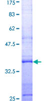 ab158839 on a 12.5% SDS-PAGE stained with Coomassie Blue.