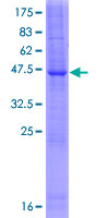 ab164613 on a 12.5% SDS-PAGE stained with Coomassie Blue.