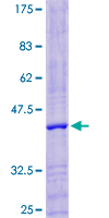 ab165345 on a 12.5% SDS-PAGE stained with Coomassie Blue.