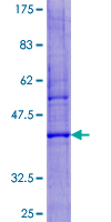 ab163503 on a 12.5% SDS-PAGE stained with Coomassie Blue.