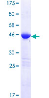 ab164574 on a 12.5% SDS-PAGE stained with Coomassie Blue.