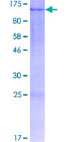 ab159966 on a 12.5% SDS-PAGE stained with Coomassie Blue.